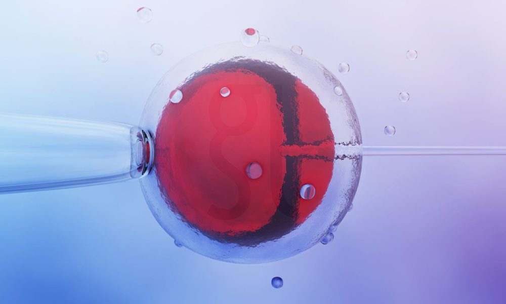 What is IVF A Full Guide to In Vitro Fertilization