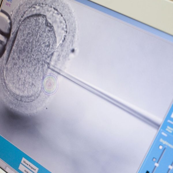 gynolife fertility cyprus