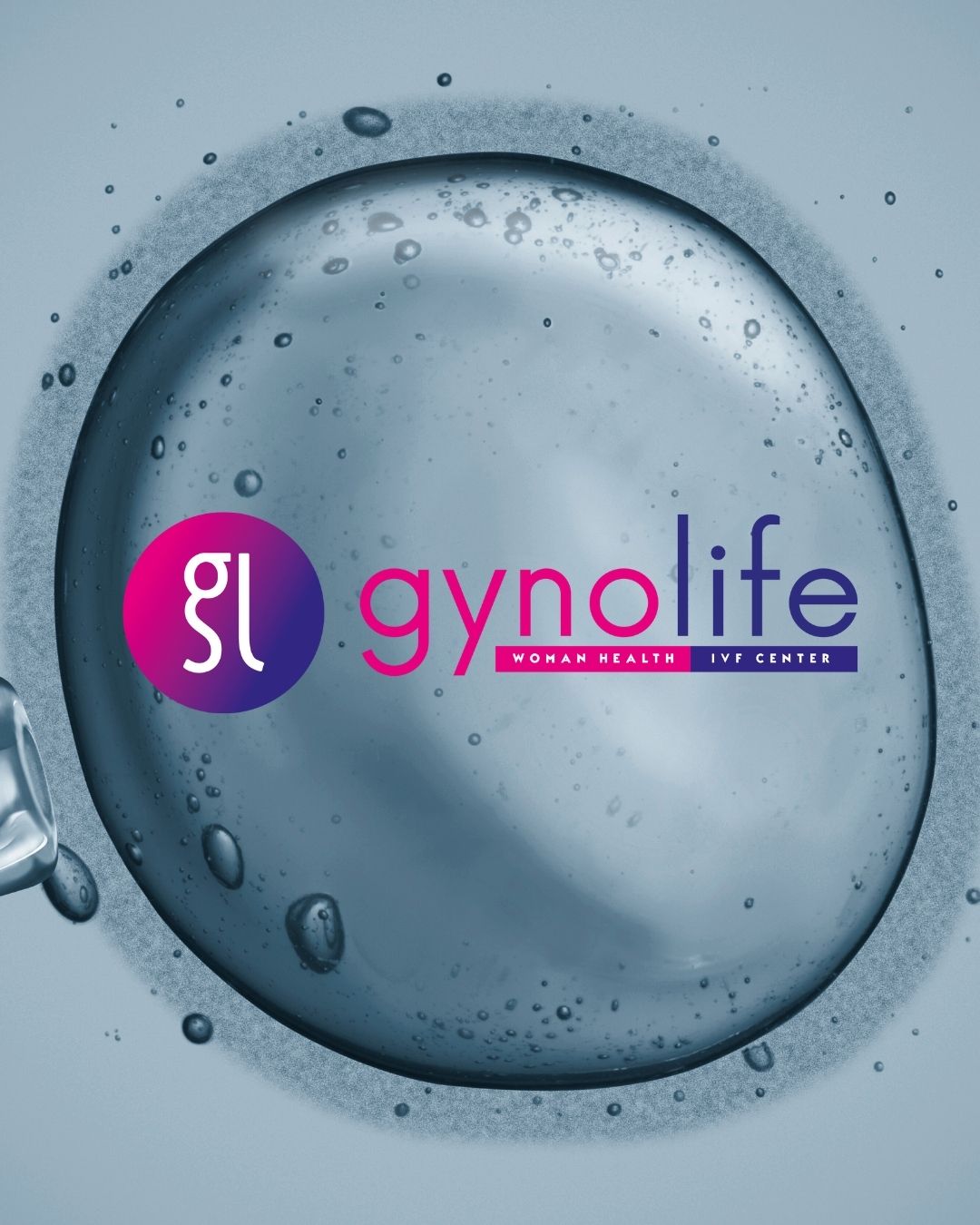 ivf fertility cyprus