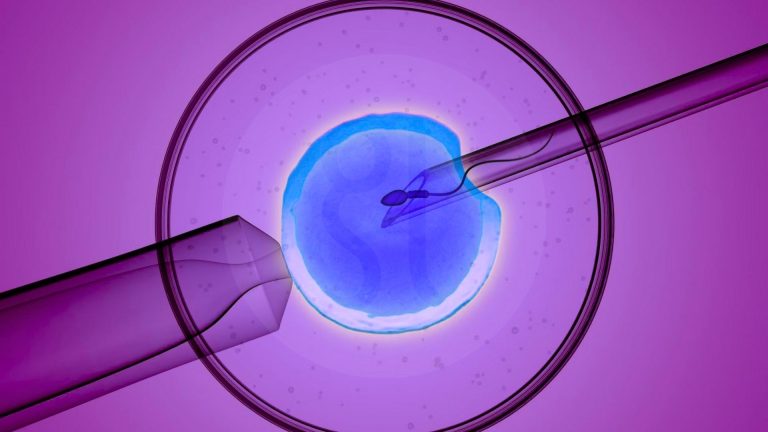 Microchip IVF